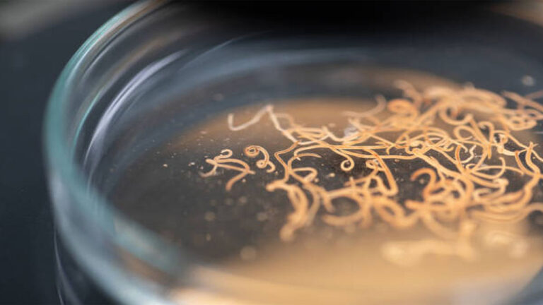 Berkaca dari Kasus Raya, Ini Penyebab Cacingan pada Anak dan Orang Dewasa yang Harus Diwaspadai