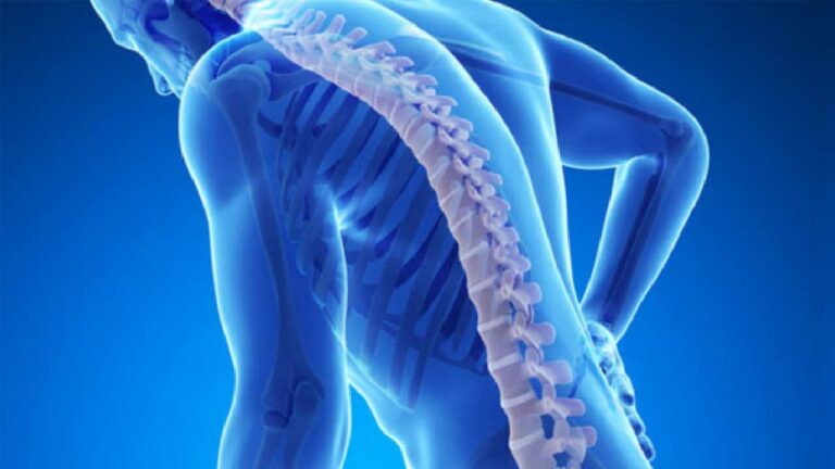 Bangun Kepadatan Tulang Sejak Muda: Cegah Osteoporosis Sebelum Terlambat