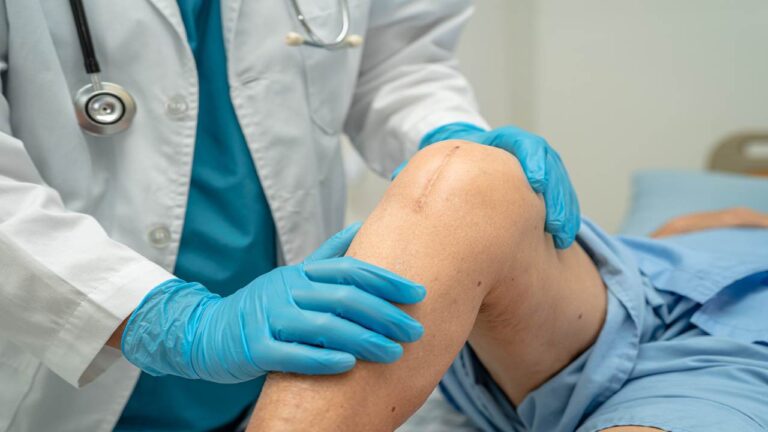 Berapa Lama Pulih Setelah Operasi Lutut? Teknologi Robotik Ini Bikin Pasien Osteoartritis Cepat Aktif Lagi