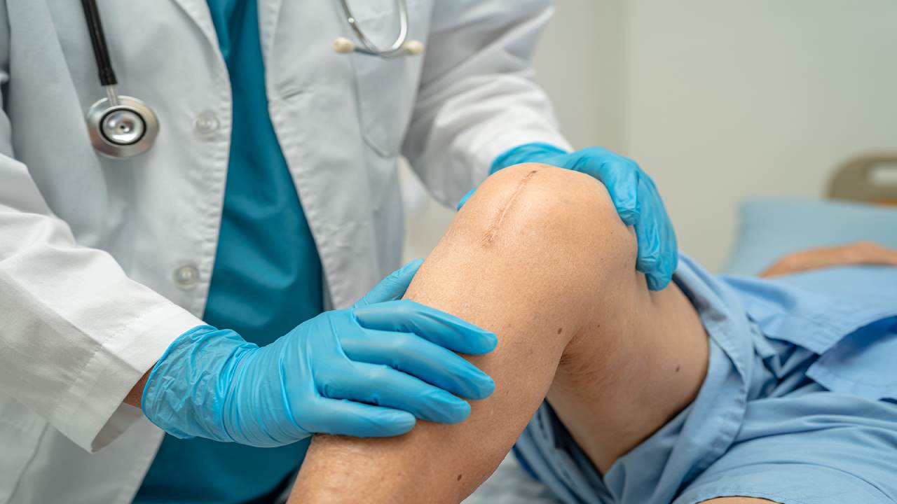 Berapa Lama Pulih Setelah Operasi Lutut? Teknologi Robotik Ini Bikin Pasien Osteoartritis Cepat Aktif Lagi