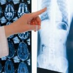 ISPA Masih Menghantui Pekerja Indonesia, Alarm Kesehatan Kerja di Tahun 2025