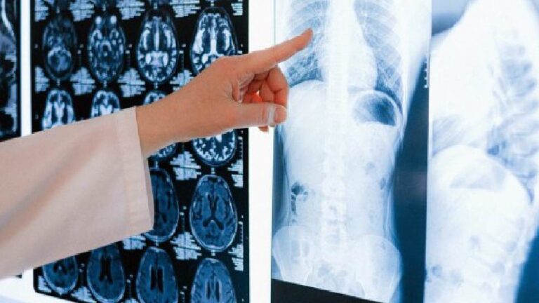 ISPA Masih Menghantui Pekerja Indonesia, Alarm Kesehatan Kerja di Tahun 2025