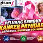 Peluang Sembuh Kanker Payudara Dipengaruhi Stadium dan Penanganan